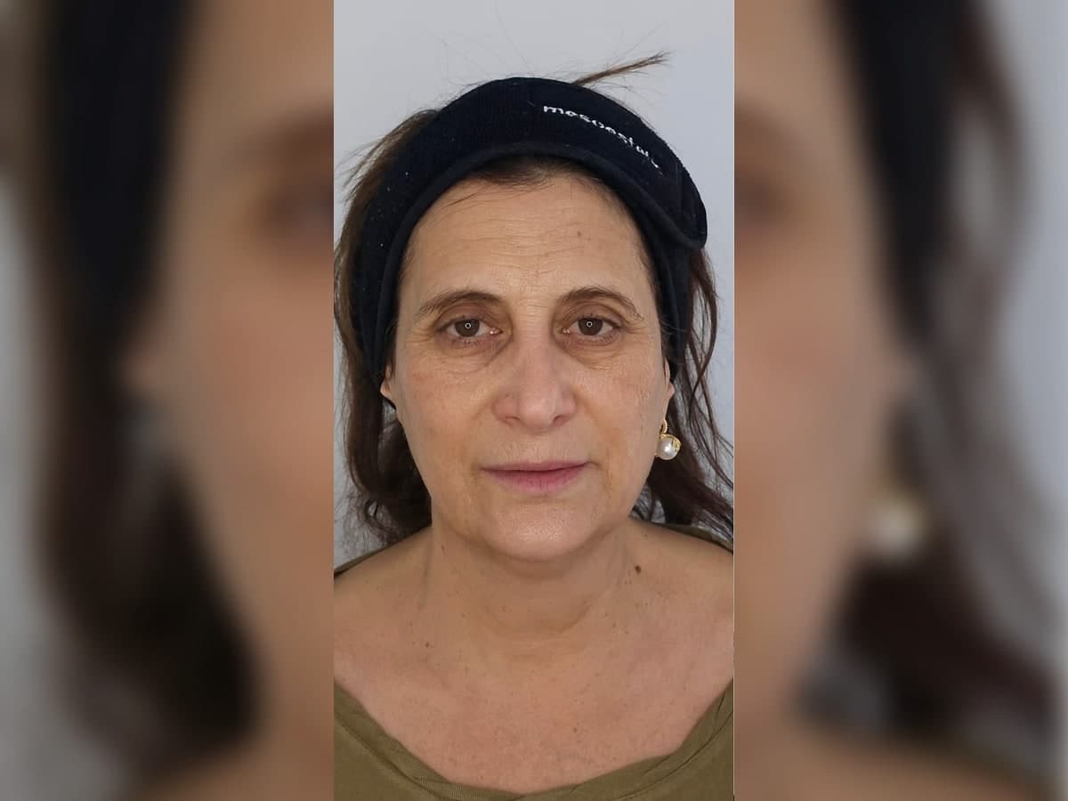 Registro previo de tratamiento facial personalizado.