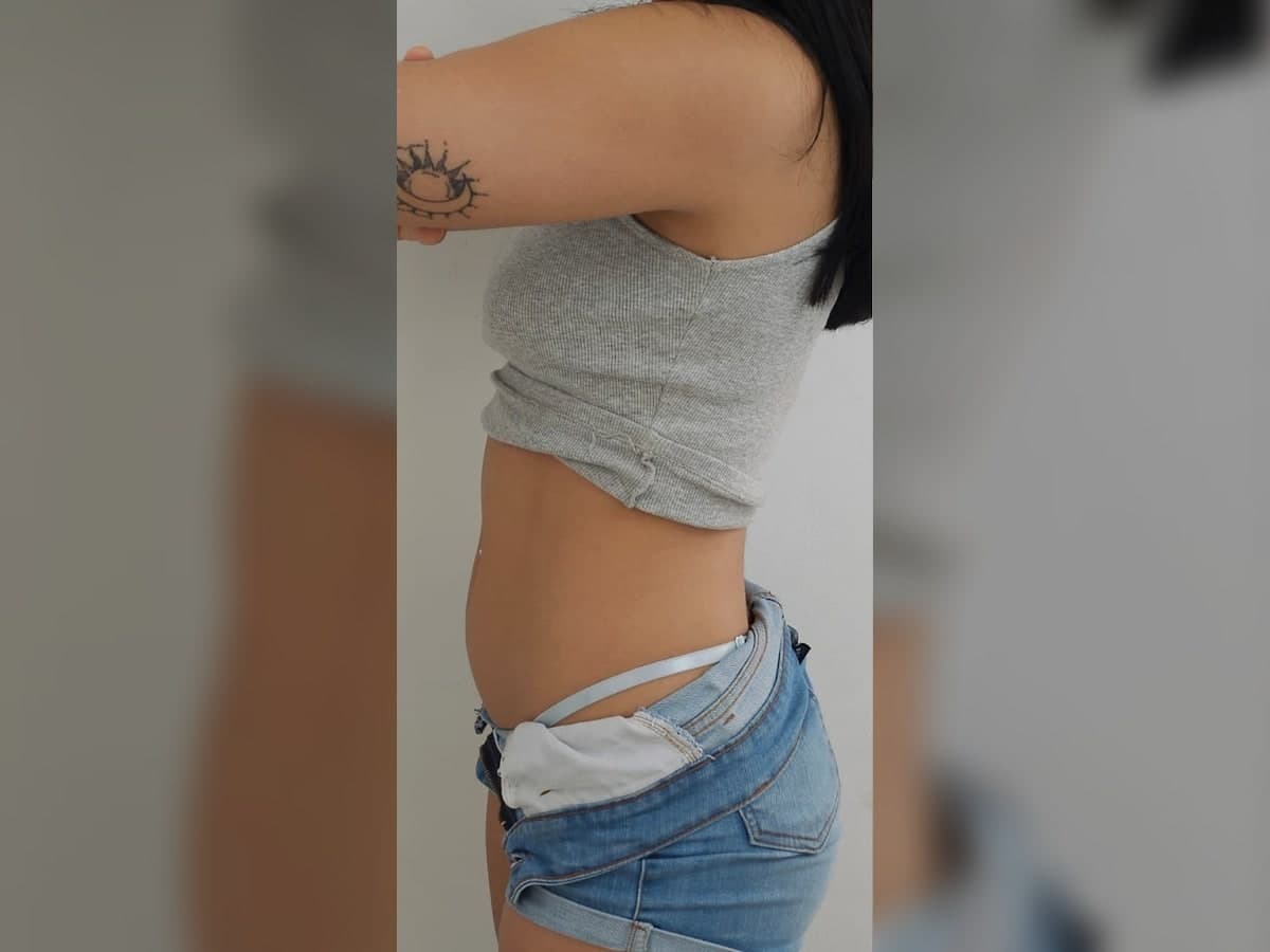 Registro previo de tratamiento corporal en perfil.
